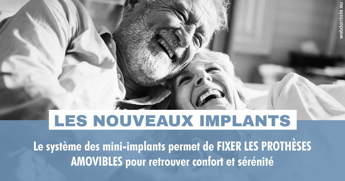 https://dr-bonnel-marc.chirurgiens-dentistes.fr/Les nouveaux implants 2