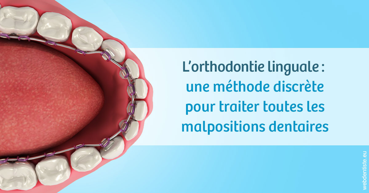 https://dr-bonnel-marc.chirurgiens-dentistes.fr/L'orthodontie linguale 1