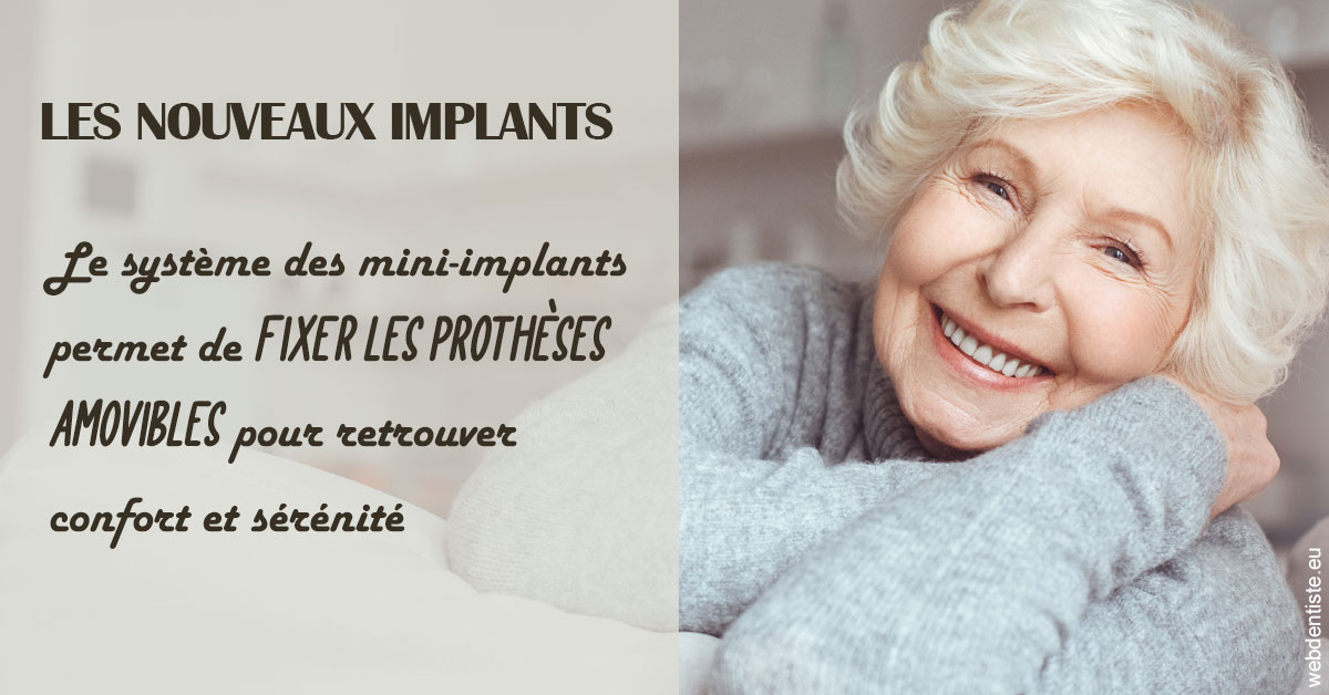 https://dr-bonnel-marc.chirurgiens-dentistes.fr/Les nouveaux implants 1