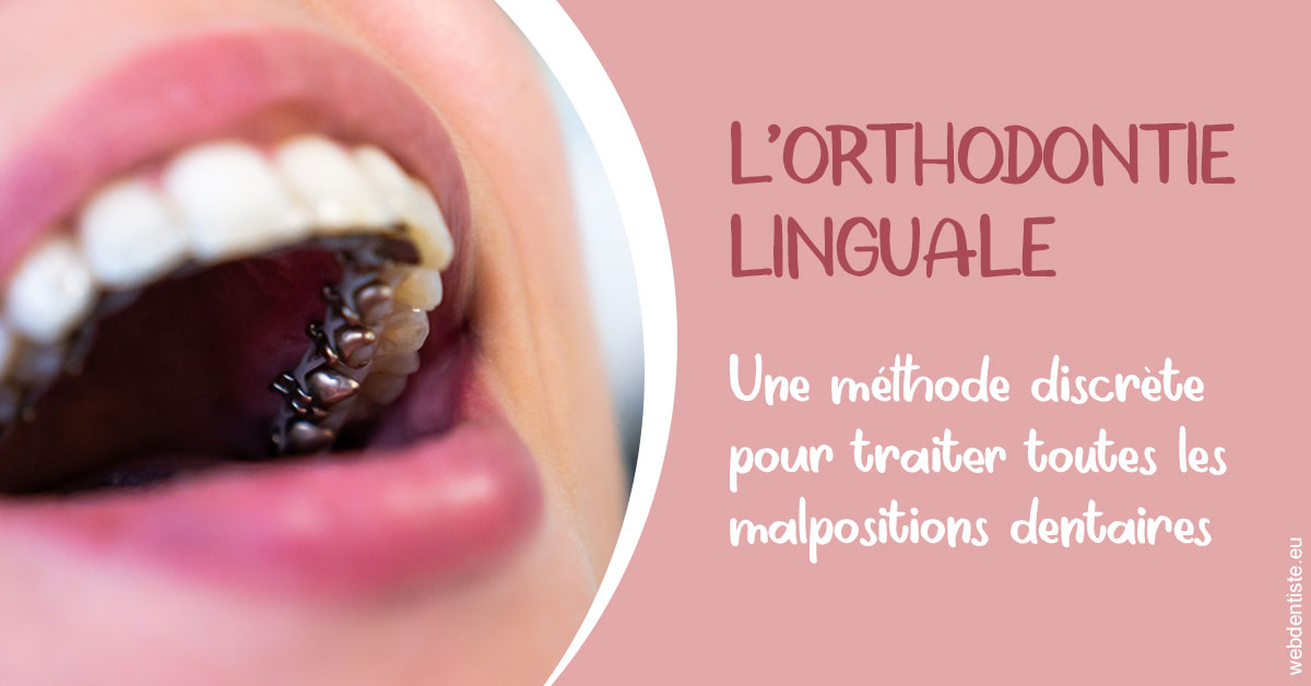 https://dr-bonnel-marc.chirurgiens-dentistes.fr/L'orthodontie linguale 2