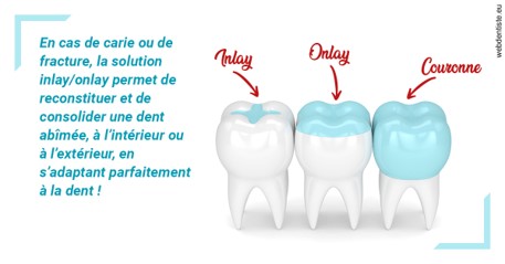 https://dr-bonnel-marc.chirurgiens-dentistes.fr/L'INLAY ou l'ONLAY