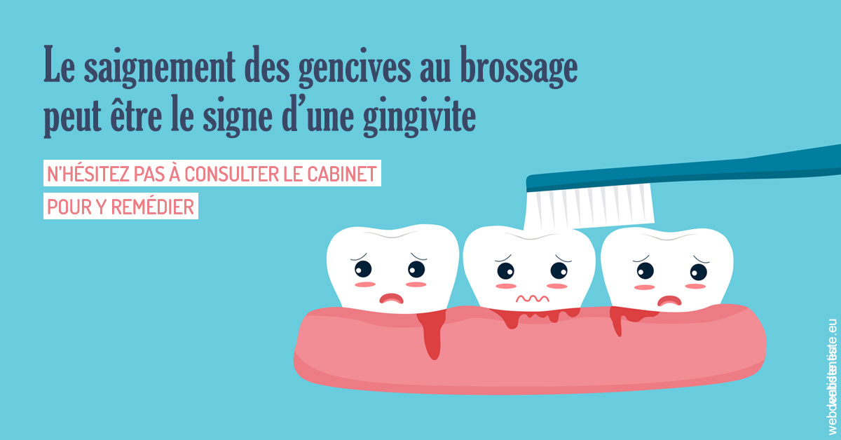 https://dr-bonnel-marc.chirurgiens-dentistes.fr/Saignement gencives 2