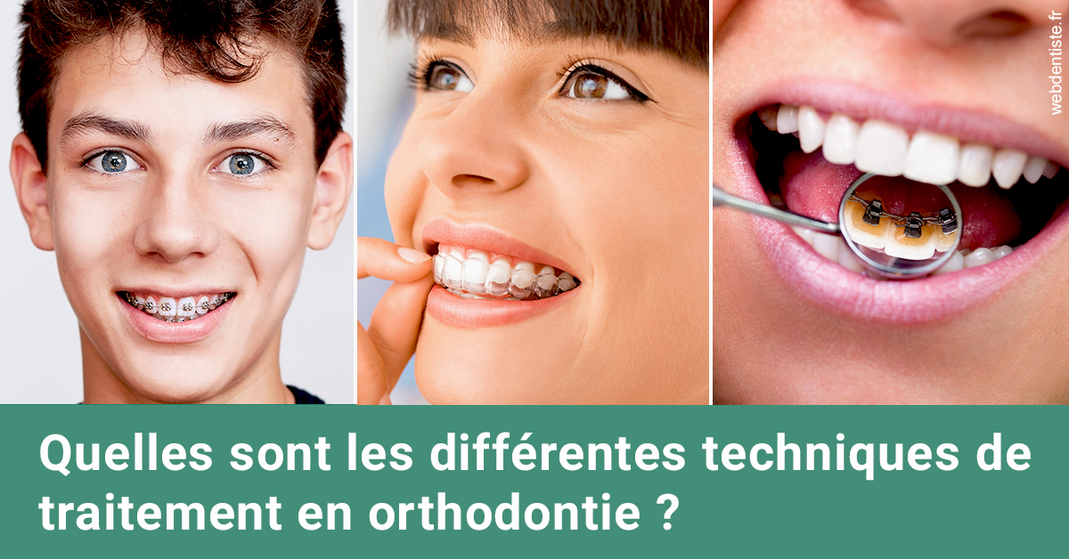 https://dr-bonnel-marc.chirurgiens-dentistes.fr/Les différentes techniques de traitement 2