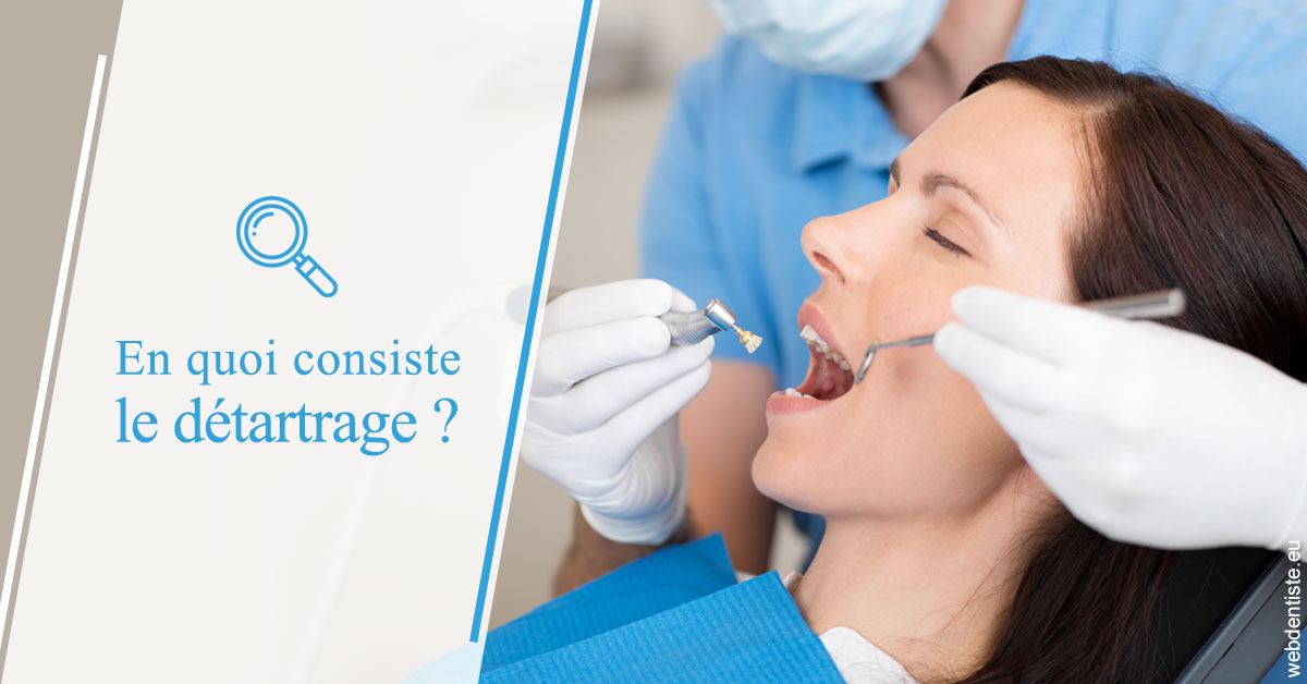 https://dr-bonnel-marc.chirurgiens-dentistes.fr/En quoi consiste le détartrage