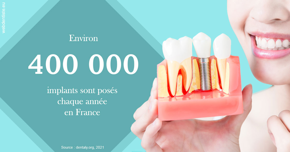 https://dr-bonnel-marc.chirurgiens-dentistes.fr/Pose d'implants en France 2