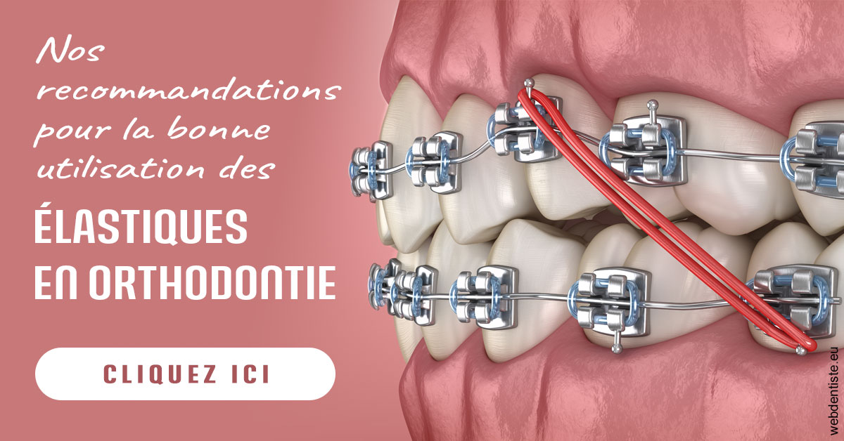 https://dr-bonnel-marc.chirurgiens-dentistes.fr/Elastiques orthodontie 2
